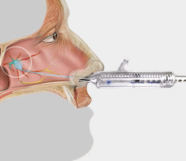 Headache sufferers consistently identified stress as the #1 trigger for their headache.